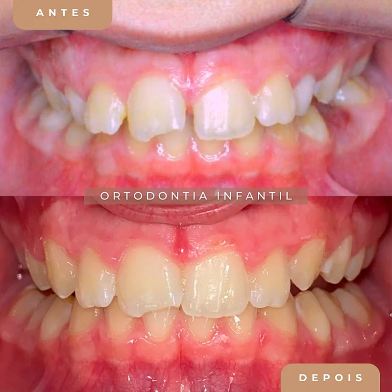 carrossel-aparelho-fixo-1