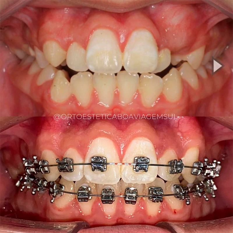 carrossel-aparelho-fixo-3