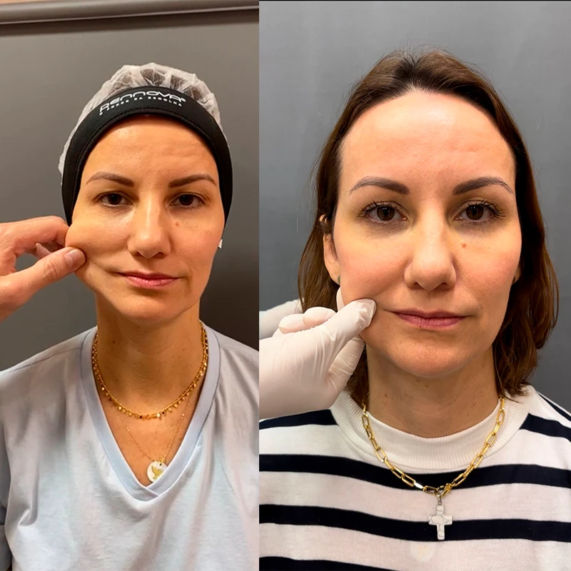 carrossel-bioestimulador-1