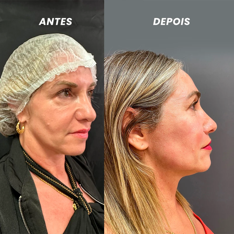 carrossel-bioestimulador-2b