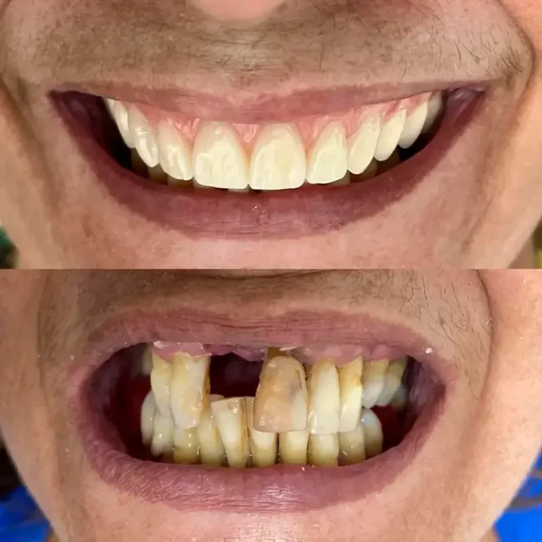 carrossel-implantes-dentarios-1