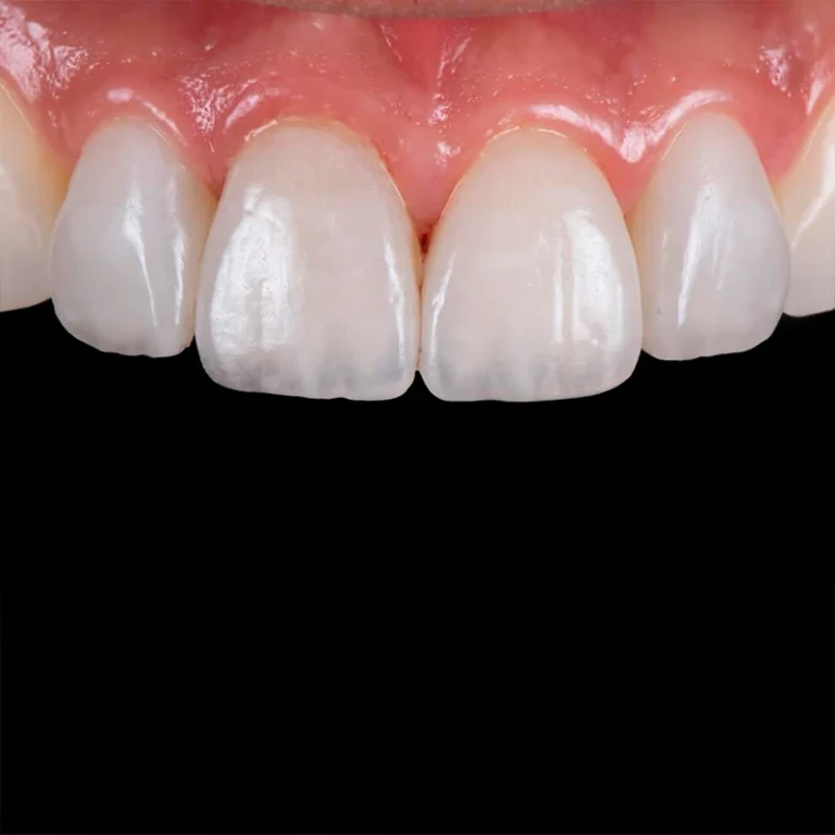 carrossel-lentes_contato-1