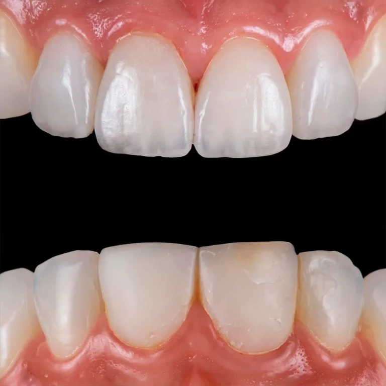 carrossel-lentes_contato-2