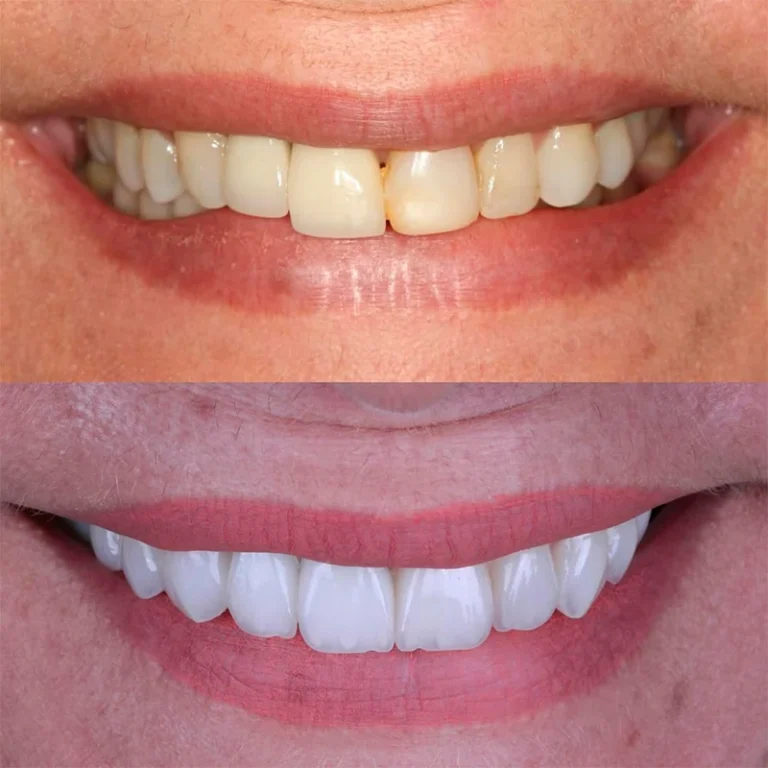 carrossel-lentes_contato-4