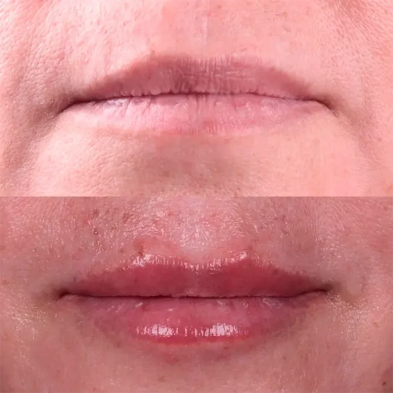 carrossel-preenchimentos-3