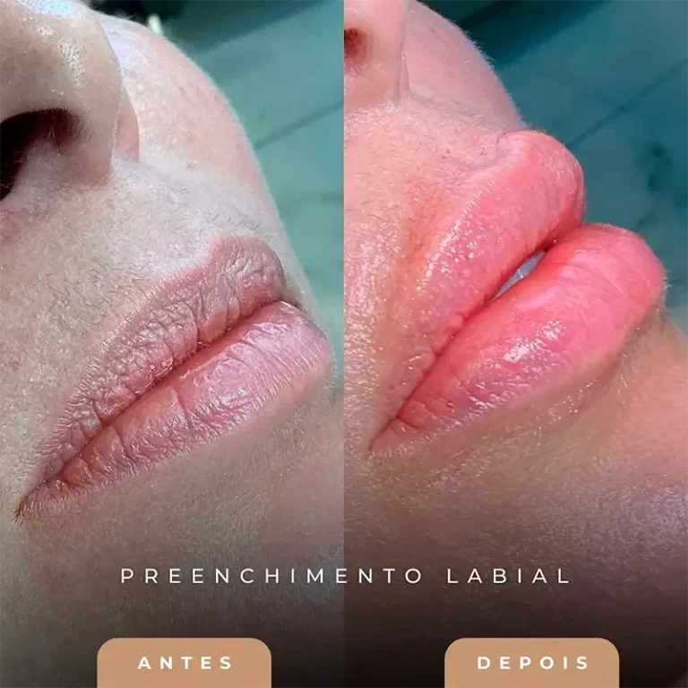 carrossel-preenchimentos-4