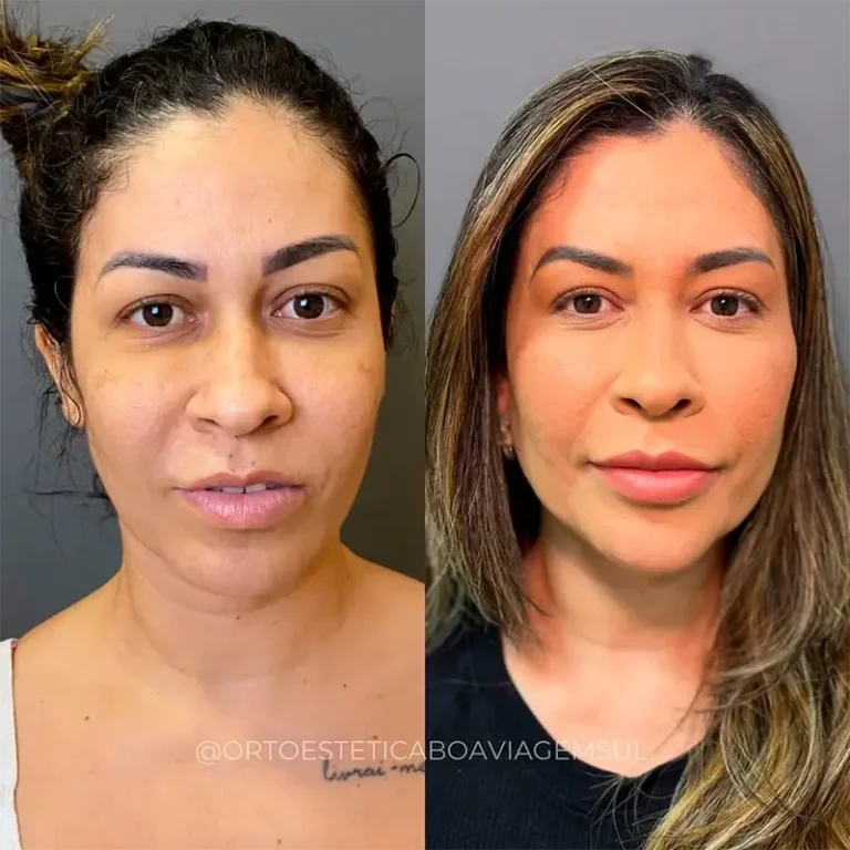 carrossel-preenchimentos-5